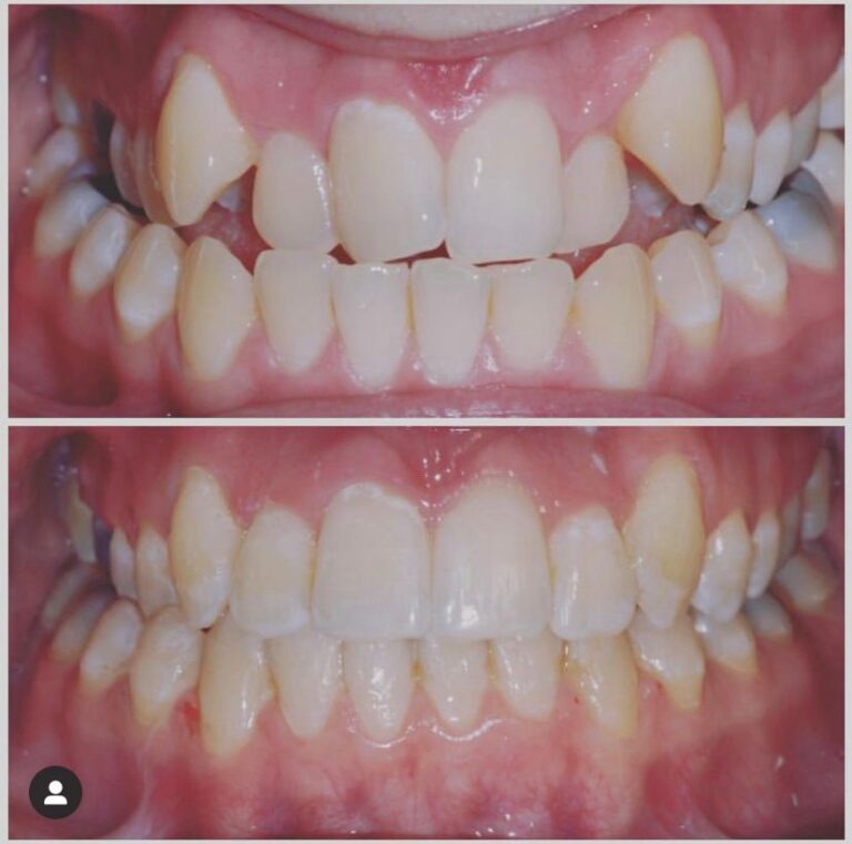 Fastbraces Watling Street Dental Care